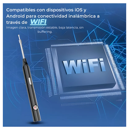 EarView™ | Elimina la cera de tus oídos con precisión profesional desde tu celular 📱👂