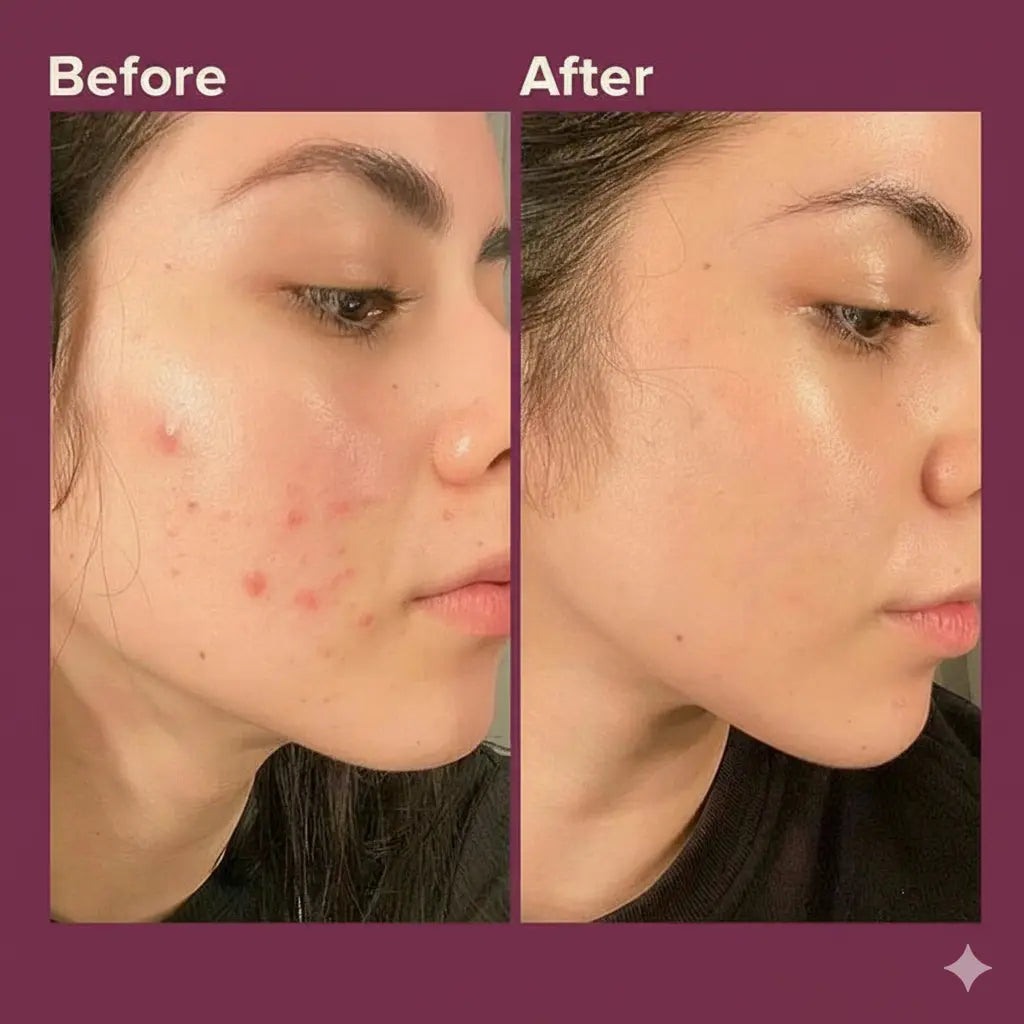 Inositol: Recupera el Equilibrio de tu Piel desde Adentro