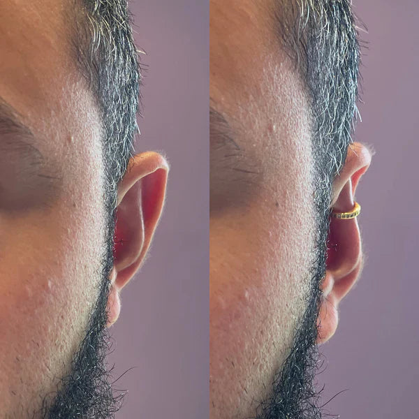 Earfix - Par de aretes que corrigen tus orejas mientras te ves increíble